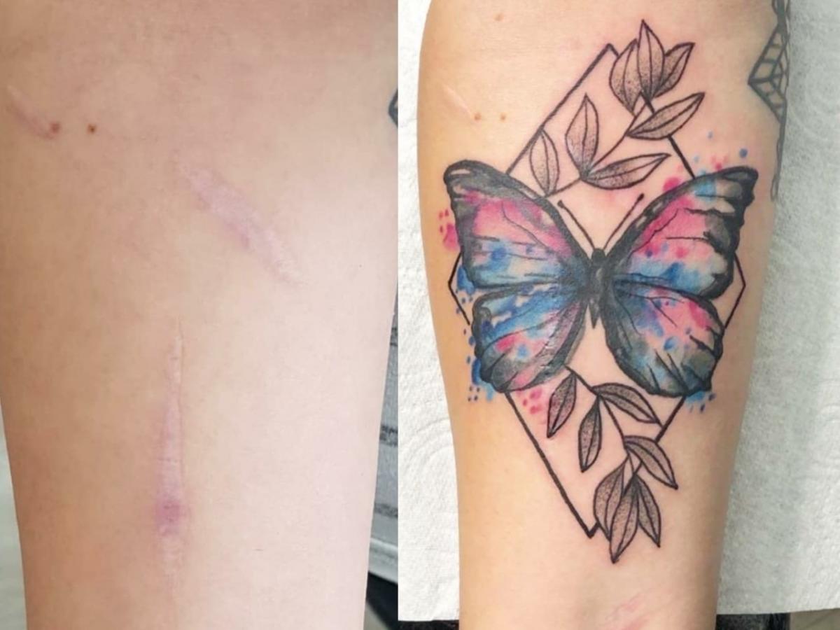 Littleport medical tattooist covers scars with colourful art | Ely Standard