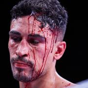 Jordan Gill suffered a deep cut to his head which forced his fight with Alan Castillo to be ruled a technical draw.