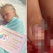 Amelia Smith was taken into surgery for an injured finger, which her mother said staff at Hinchingbrooke Hospital confirmed surgery was not required.